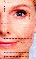 Facial lines
